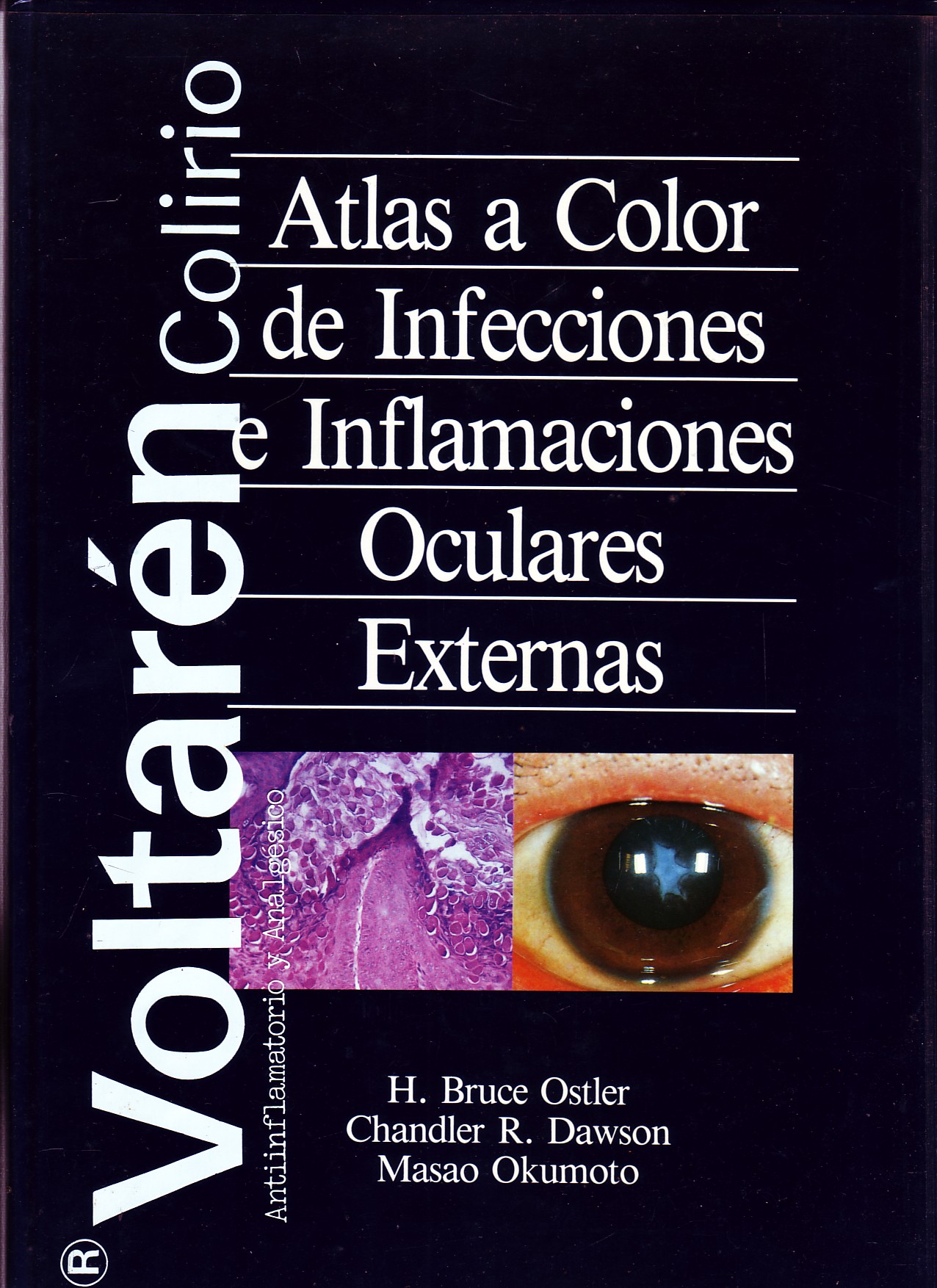 ATLAS A COLOR DE INFECCIONES E INFLAMACIONES OCULARES EXTERNAS.
