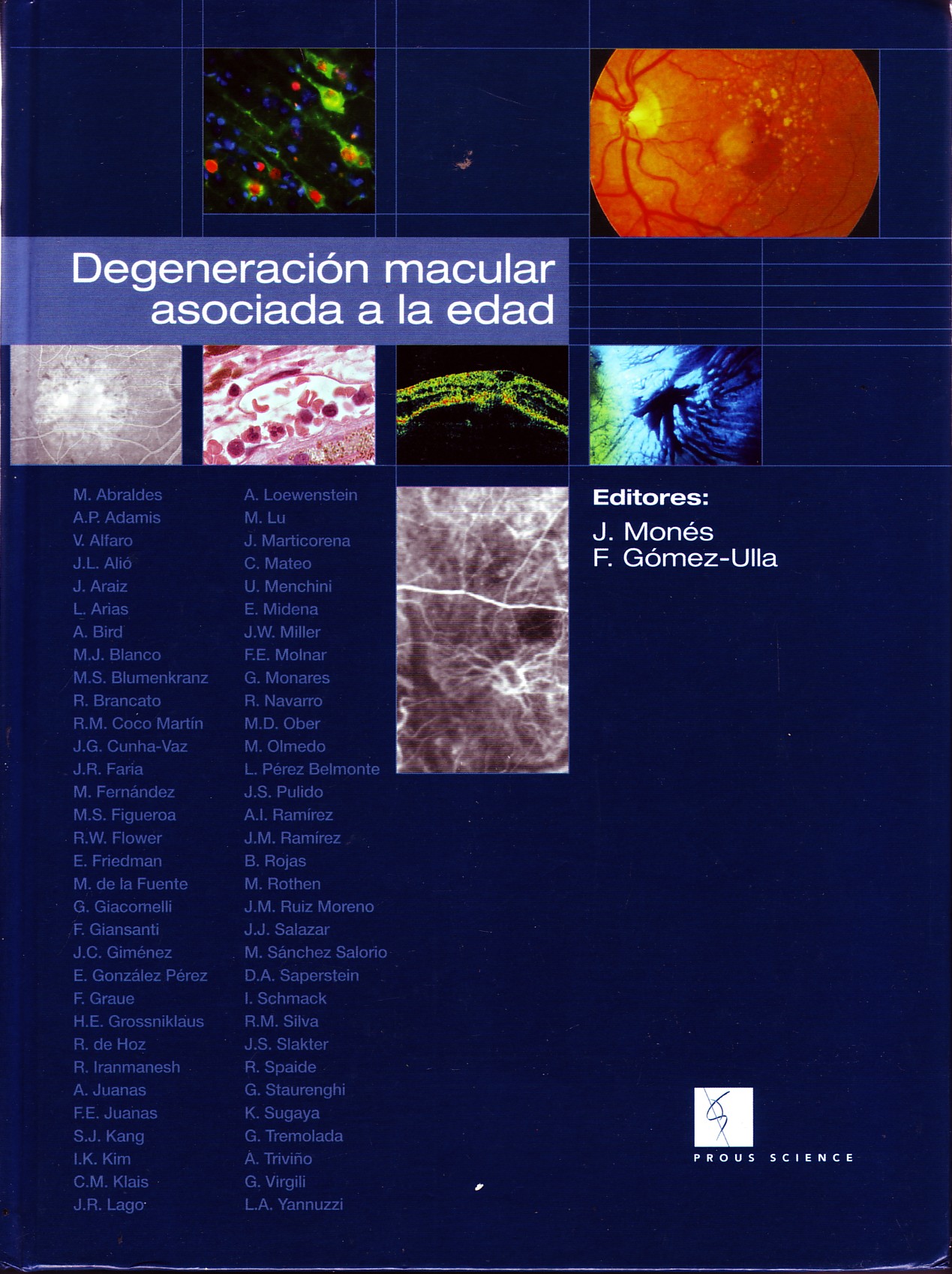 DEGENERACION MACULAR ASOCIADA A LA EDAD