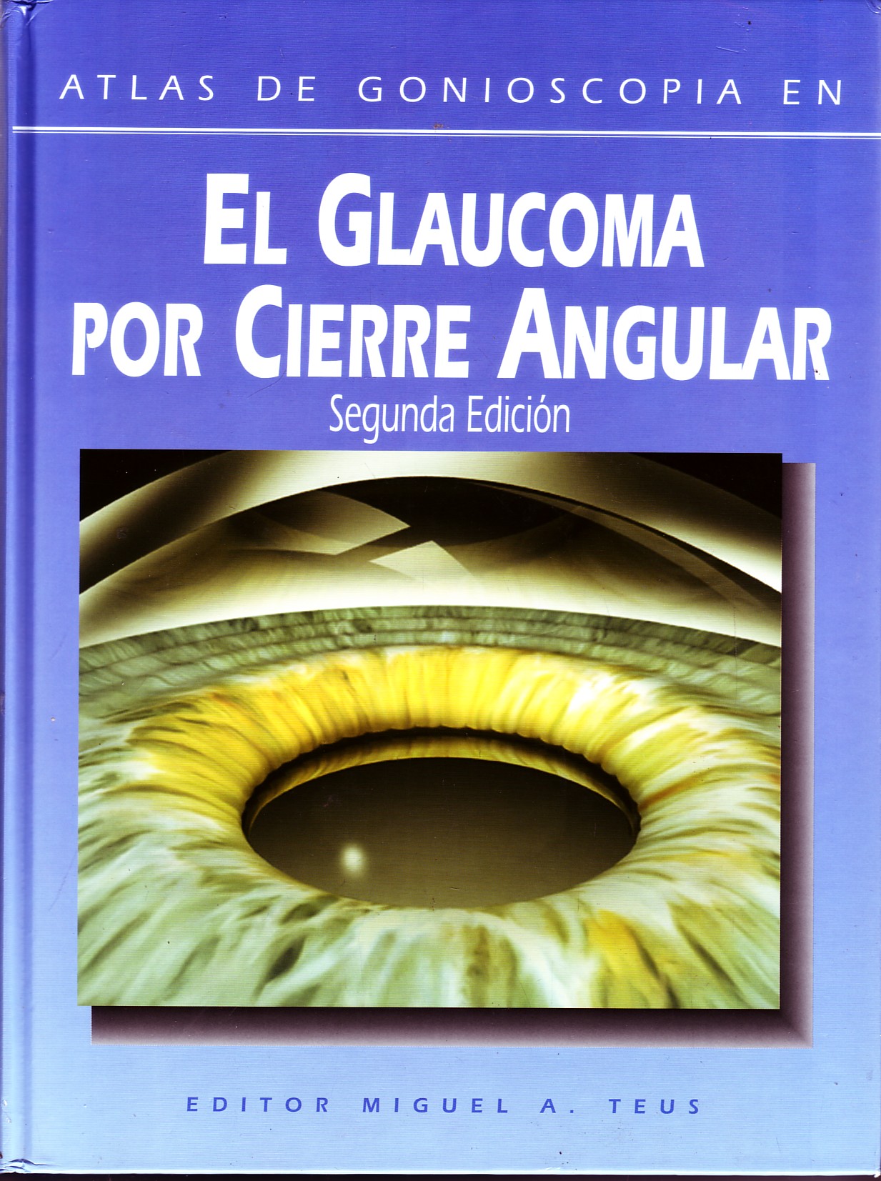 ATLAS DE GONIOSCOPIA EN EL GLAUCOMA POR CIERRE ANGULAR