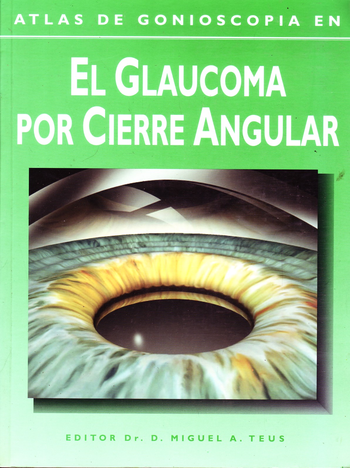 ATLAS DE GONIOSCOPIA EN EL GLAUCOMA POR CIERRE ANGULAR