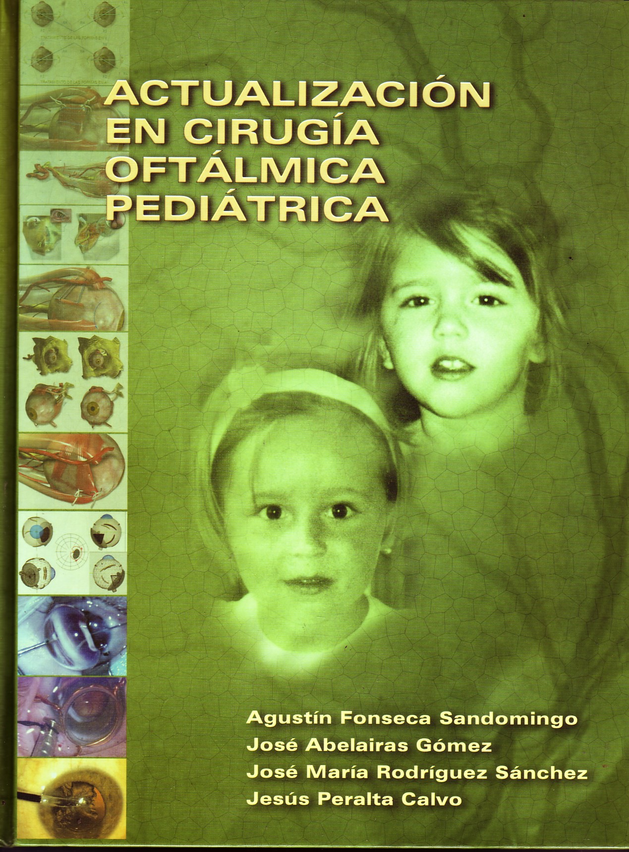 ACTUALIZACION EN CIRUGIA OFTALMICA PEDIATRICA.