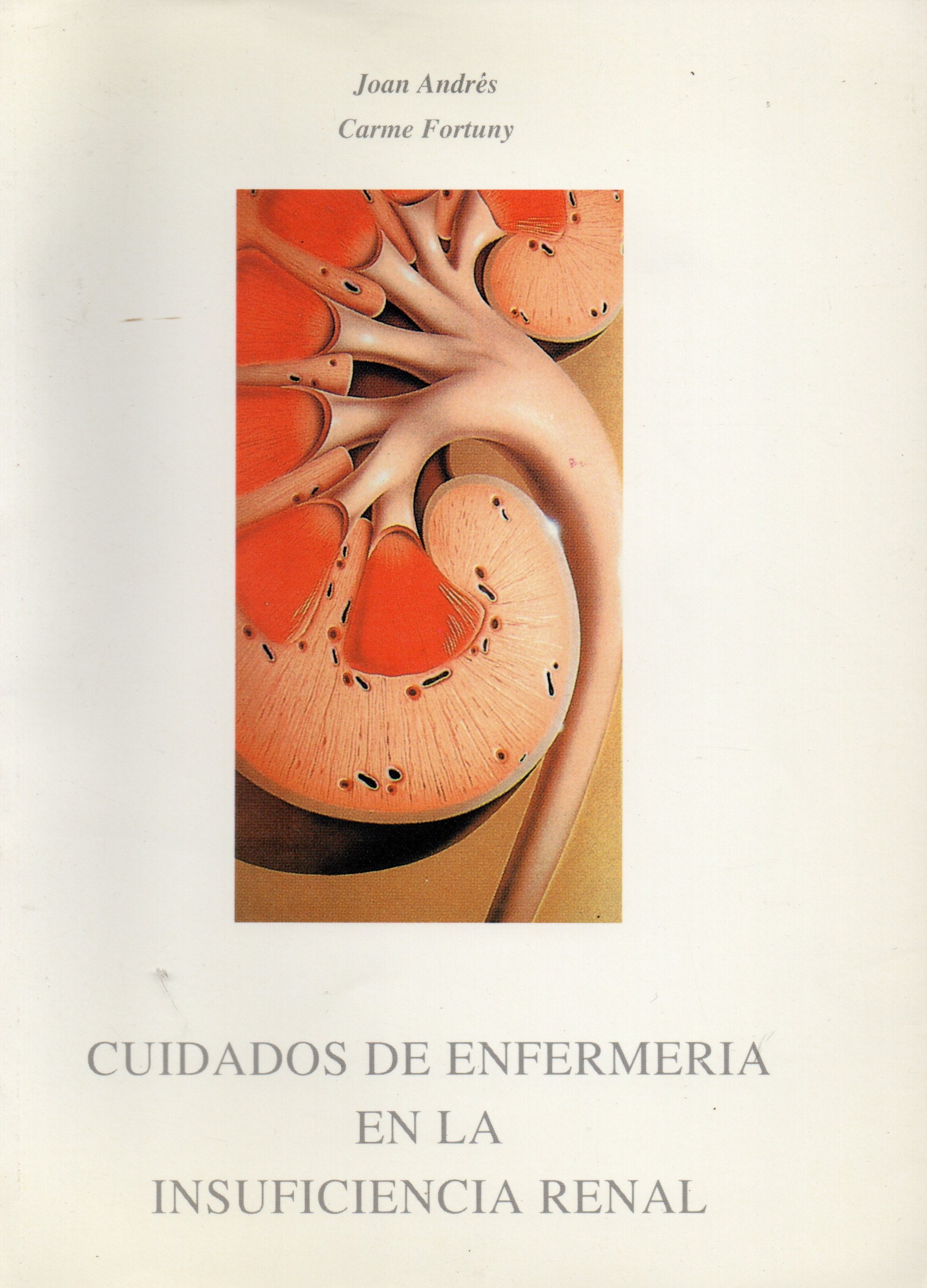 CUIDADOS DE ENFERMERIA EN EL INSUFICIENCIA RENAL