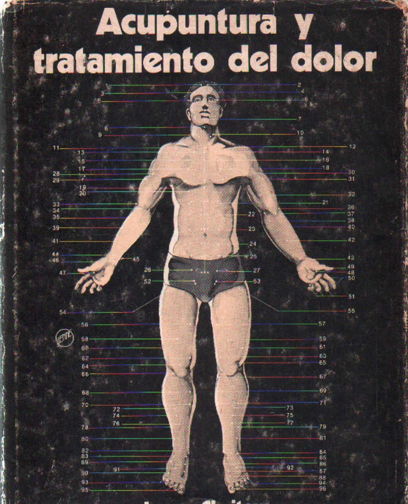 ACUPUNTURA Y TRATAMIENTO DEL DOLOR