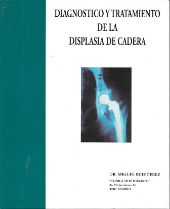 DIAGNOSTICO Y TRTAMIENTO DE LA DISPLASIA DE CADERA
