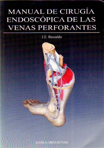 MANUAL DE CIRUGIA ENDOSCOPICA DE LAS VENAS PERFORANTES