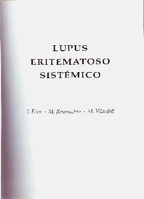 LUPUS ERITEMATOSO SISTEMICO