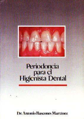 PERIODONCIA PARA EL HIGIENISTA DENTAL
