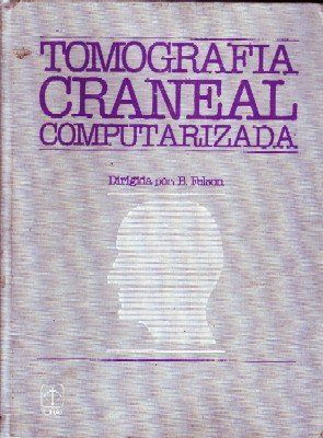 TOMOGRAFIA CRANEAL COMPUTARIZADA