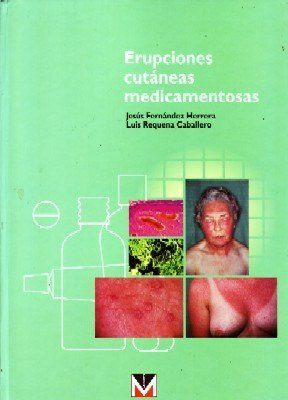 ERUPCIONES CUTANEAS MEDICAMENTOSAS