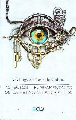 ASPECTOS FUNDAMENTALES DE LA RETINOPATIA DIABETICA