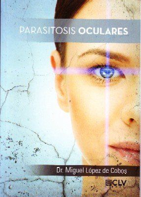 PARASITOSIS OCULARES