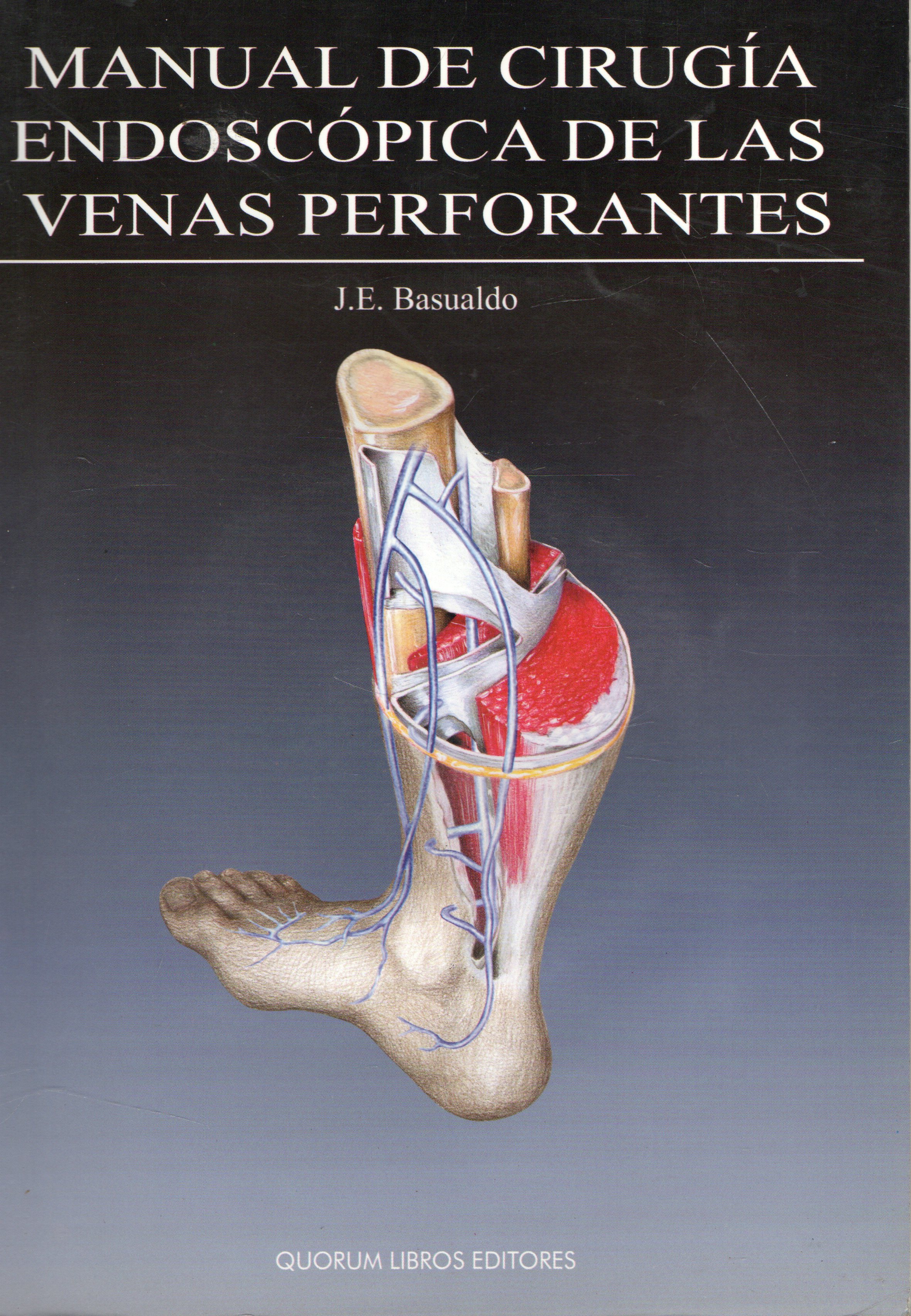 MANUAL DE CIRUGIA ENDOSCOPICA DE LAS VENAS PERFORANTES